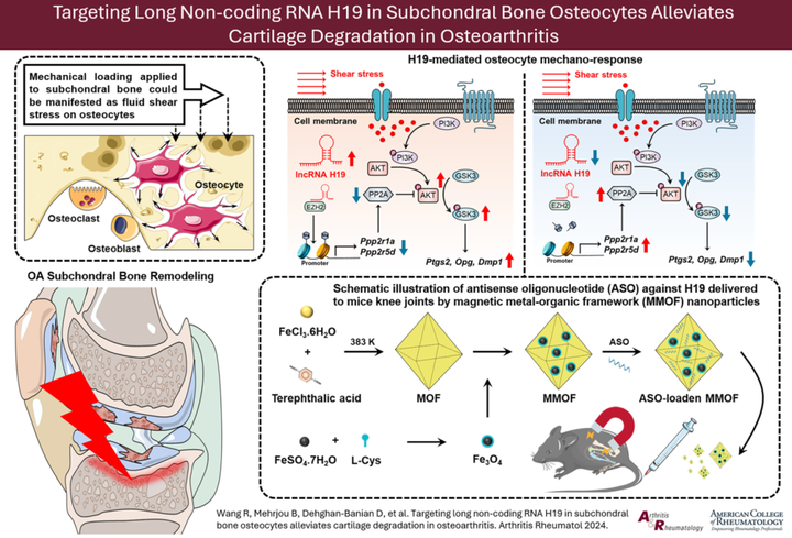 靶向軟骨下骨骨細(xì)胞中的 H19 可減輕骨關(guān)節(jié)炎軟骨降解