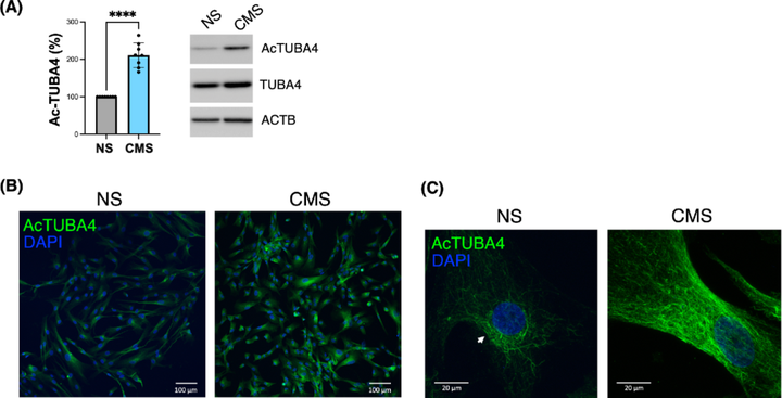 微管蛋白乙?；鰪?qiáng)機(jī)械應(yīng)力下小梁網(wǎng)細(xì)胞的微管穩(wěn)定性