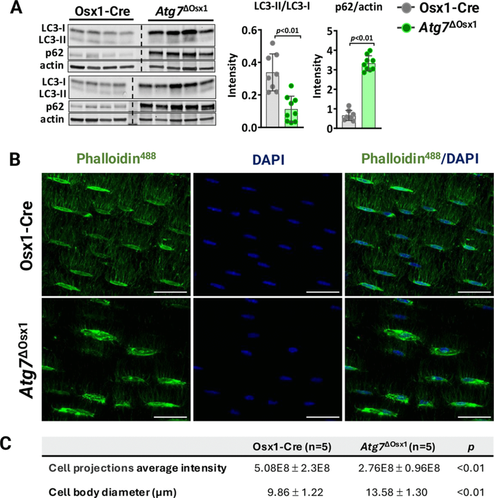成骨細(xì)胞系細(xì)胞中的線粒體氧化應(yīng)激或自噬減少不足以模擬衰老對骨機(jī)械反應(yīng)性的有害影響