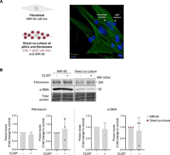 在漿細(xì)胞樣樹突狀細(xì)胞系中促進(jìn)內(nèi)質(zhì)網(wǎng)應(yīng)激可驅(qū)動(dòng)成纖維細(xì)胞活化